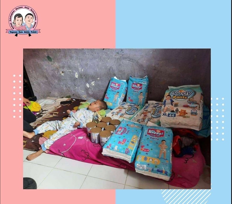 Salah-satu dari 11 anak berkebutuhan khusus yang mendapatkan bantuan susu khusus dan perlengkapan bayi dari Yayasan Rumah Adelio Peduli
